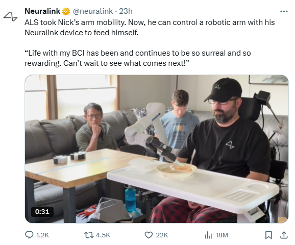 Neuralink重大突破：渐冻症患者实现意念操控机械臂进食