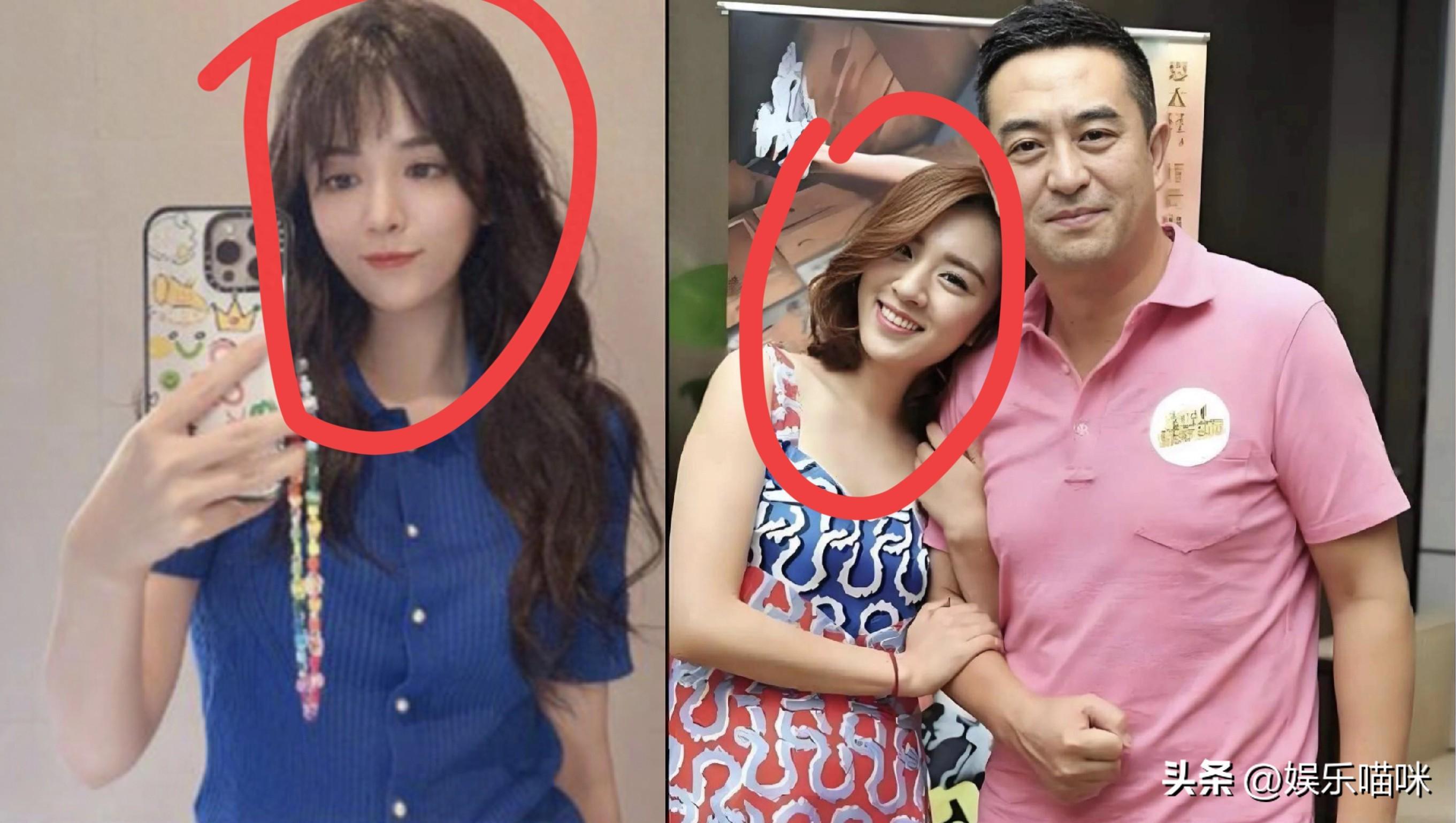 王晓晨医美变脸引争议，陈好自然老去更显魅力