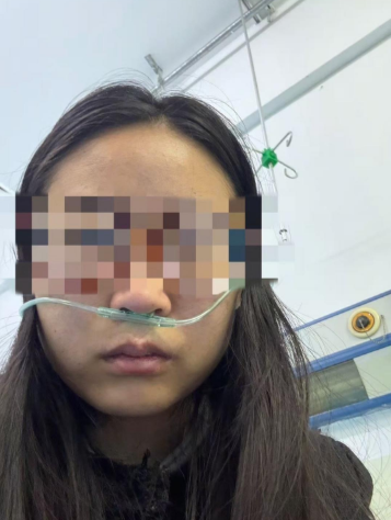 鄂尔多斯女子称因工资纠纷遭老板殴打 警方介入调查