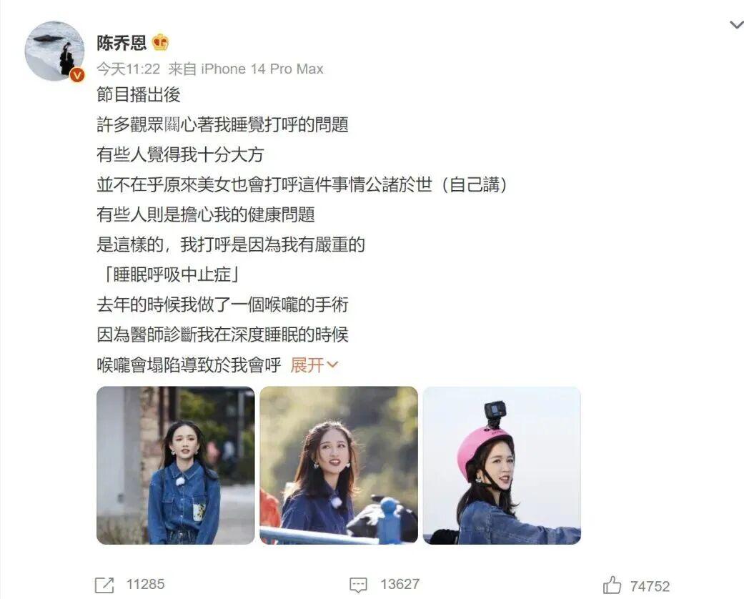 陈乔恩自曝睡眠呼吸问题