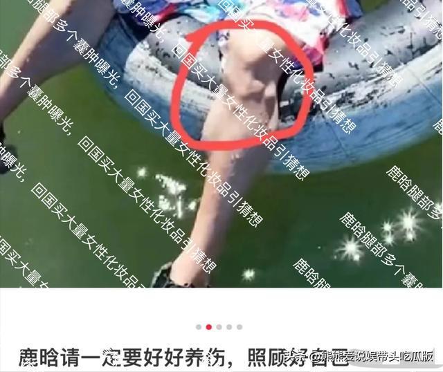 鹿晗腿部囊肿引关注，回国购女性化妆品引猜测，关晓彤举动受热议