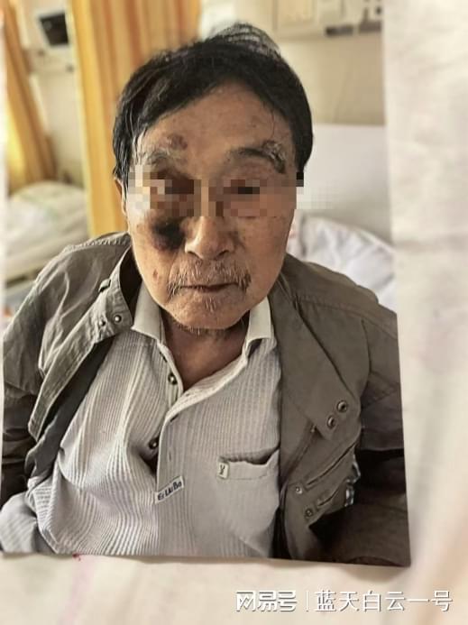 八旬老人上海医院治血糖致瘫痪后自尽，家属索赔120万