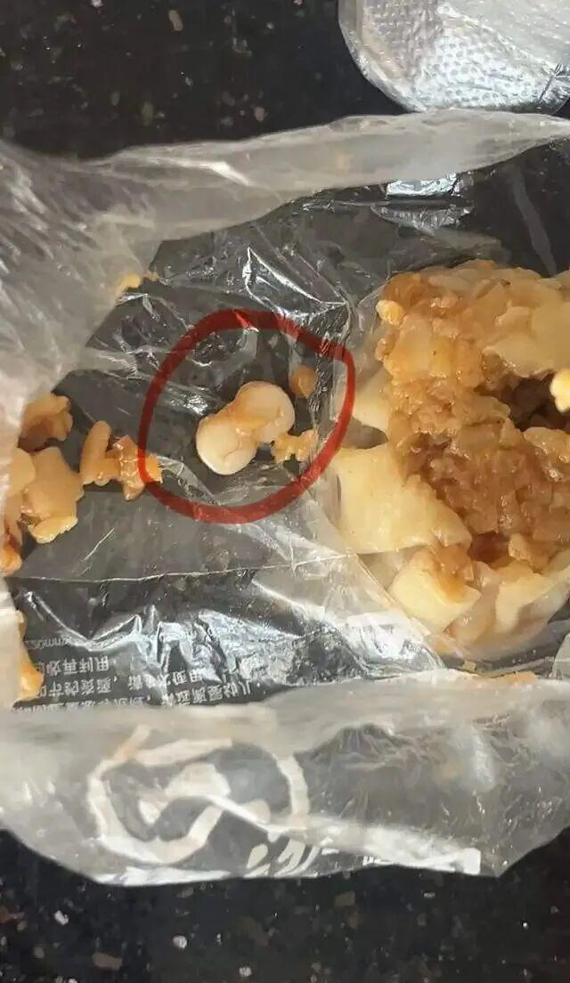 广东东莞烧麦惊现异物！网友吃出两颗相连牙齿引热议