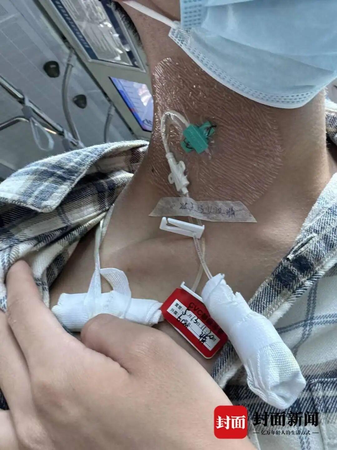 19岁重庆小伙自查确诊罕见病 全国患者不足200人