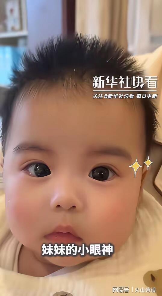 神奇双胞胎！兄妹眼睛差异大引热议，科学难解遗传之谜