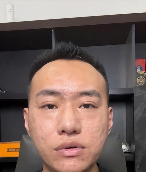 网红张树林砸神像后消失40天，复出后面相大变引热议