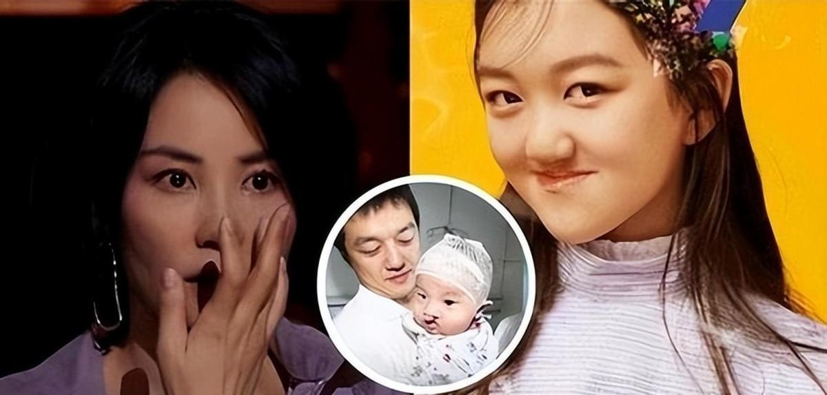 王菲女儿李嫣百万治唇裂：修复之路与外貌争议