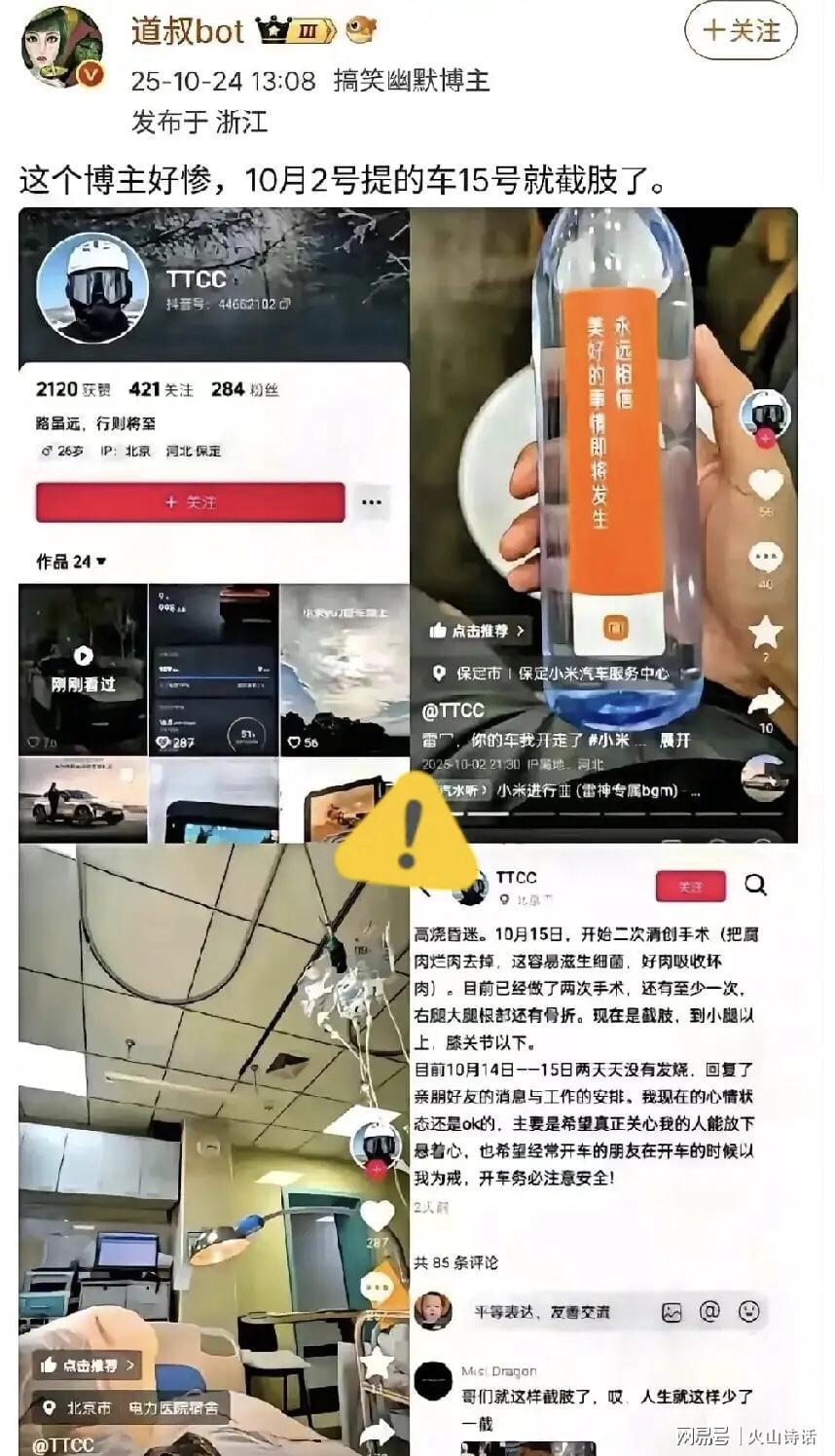 提车仅7天便截肢！车主血泪教训警示安全驾驶重要性