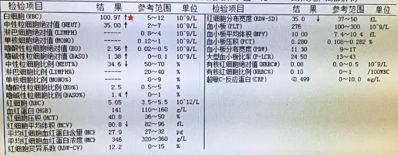 儿童白血病高发？医生提醒：这4种家居物品是隐患，赶紧排查！