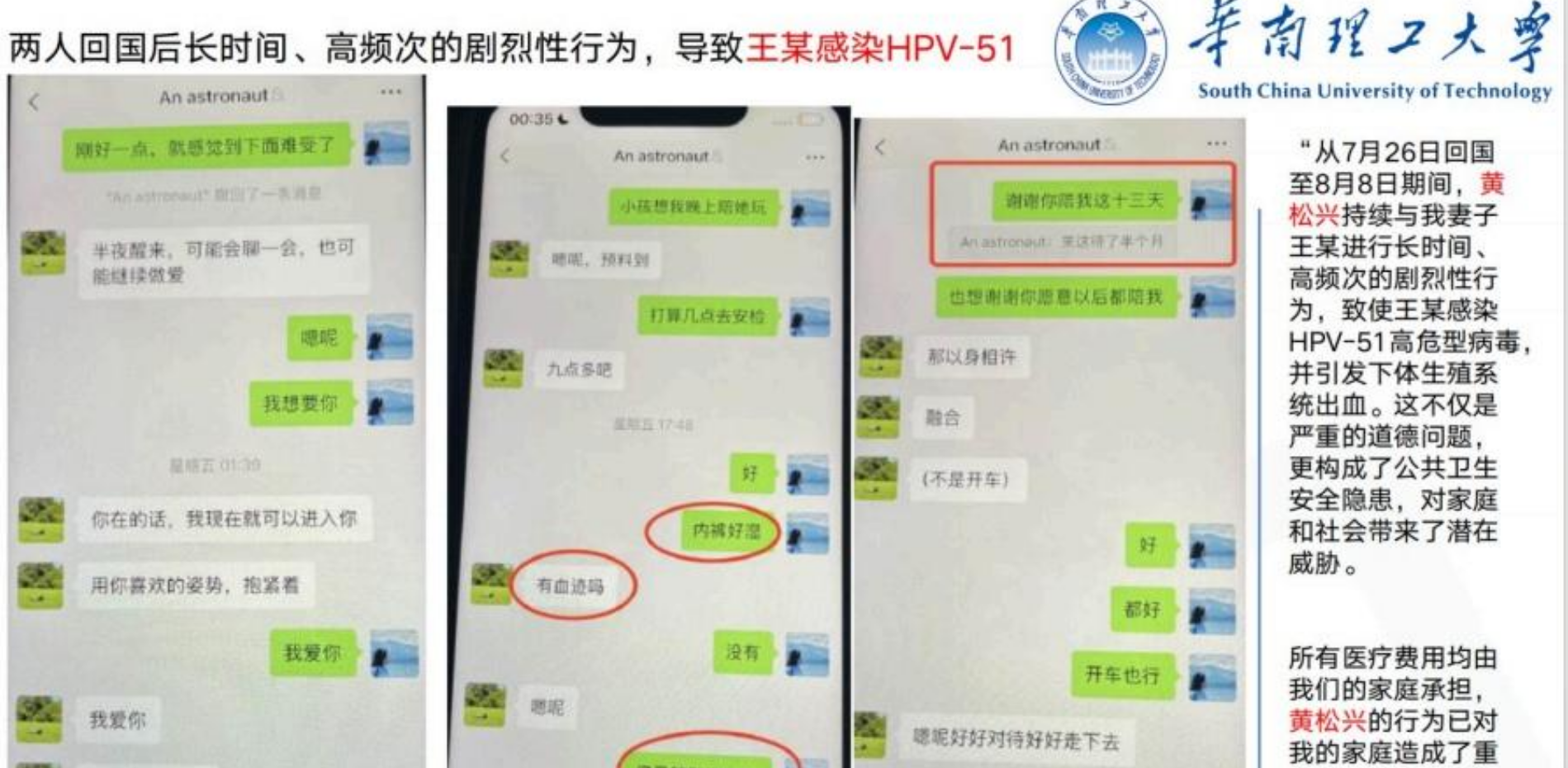 王某感染HPV