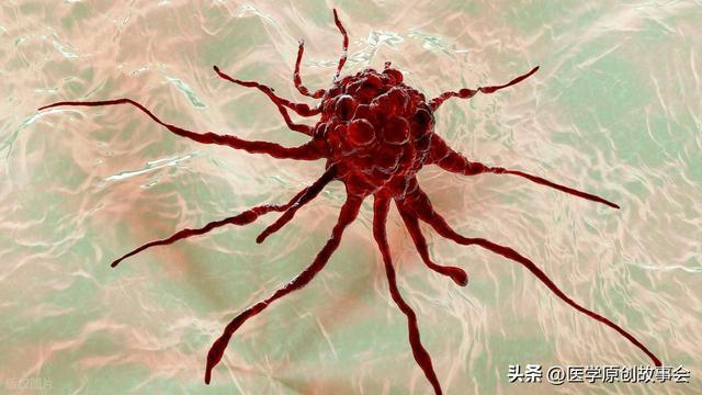 泌尿系统肿瘤筛查