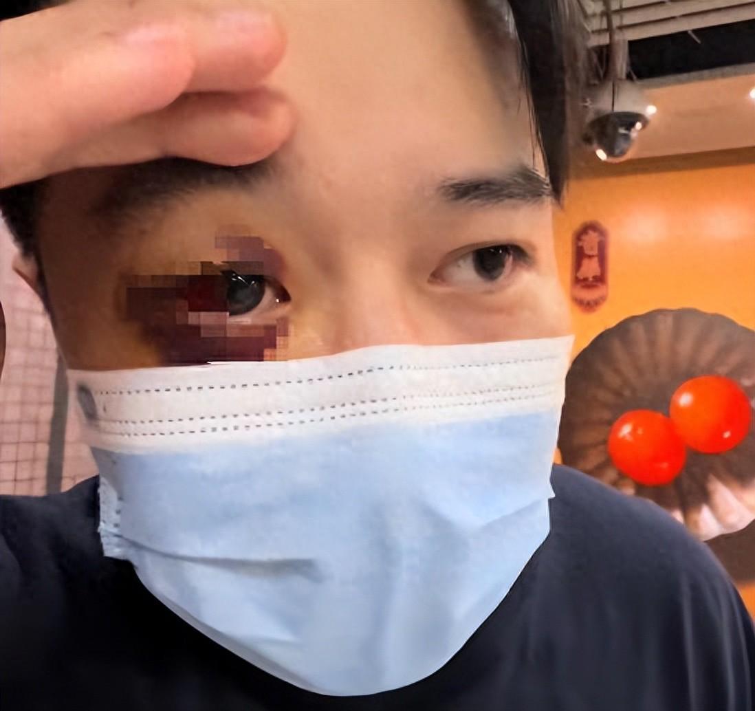香港地铁男子遭殴打致重伤，25万手术费引发和解争议