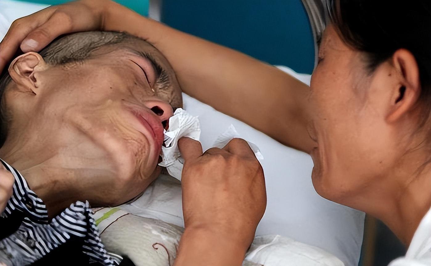 肺癌早期症状揭秘：5种身体异常信号需警惕，早筛是关键