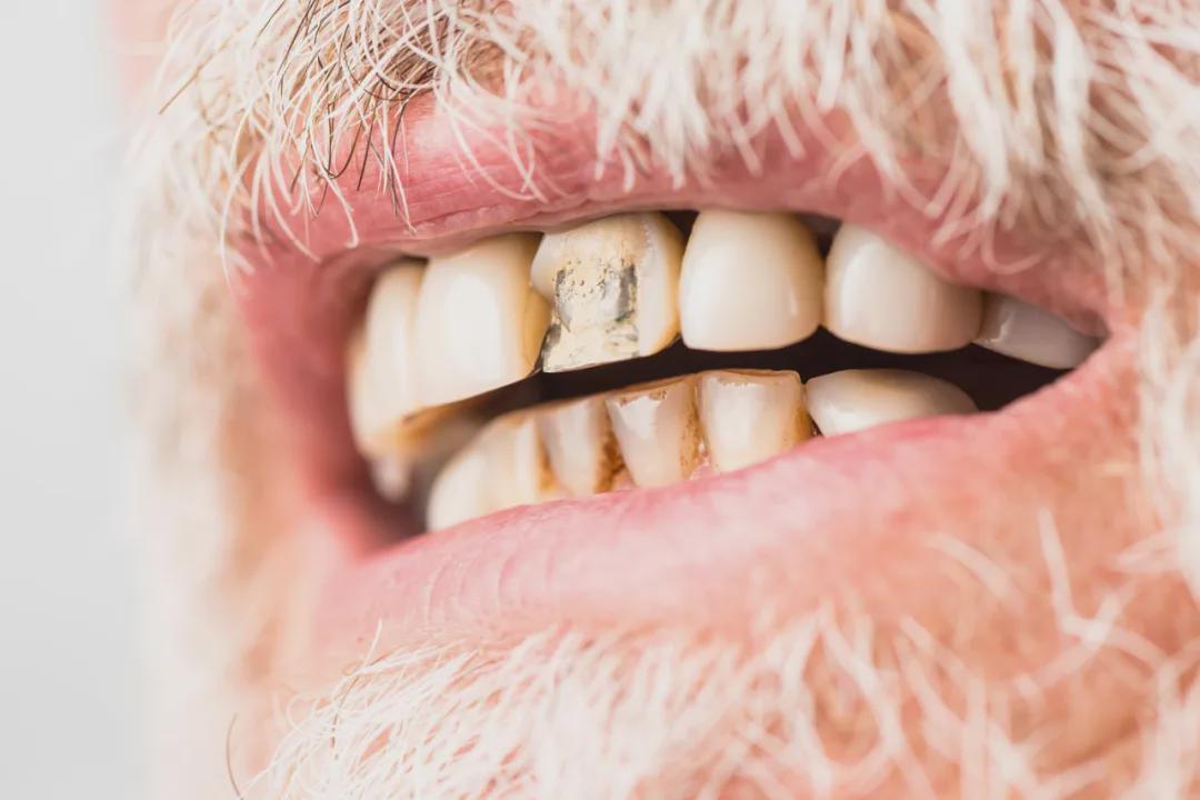 颠覆认知！日本发现牙齿再生总开关，人类离长出新牙又近了一步？