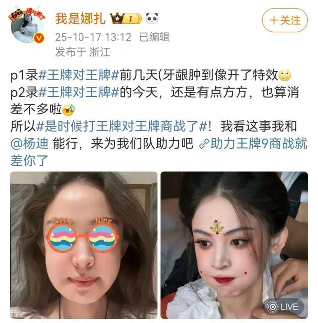 古力娜扎牙龈肿痛似‘蜜蜂小狗’，自曝脸肿引热议
