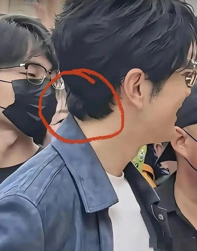 黄晓明假发引热议：茂盛发量背后的真相