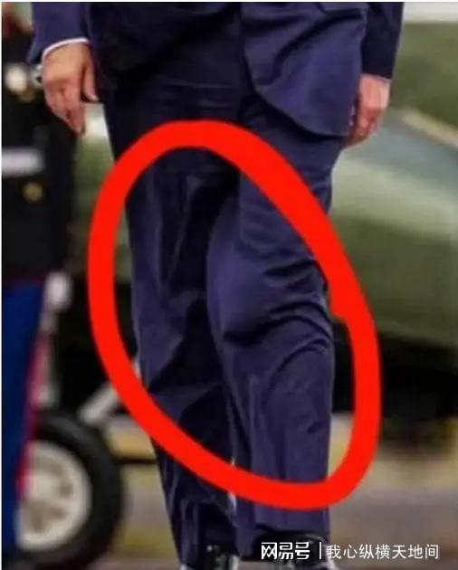 特朗普被曝裤腿藏尿袋：健康争议背后的政治诚信拷问